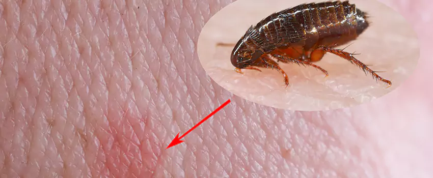 Flea Control for Humans Royse City, TX